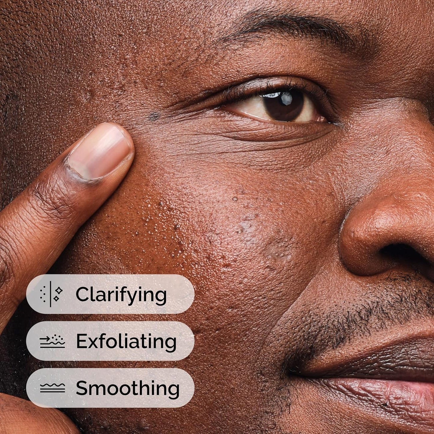 The Ordinary Salicylic Acid 2% Solution, Acne-Fighting Serum for Blemish-Prone Skin My Store